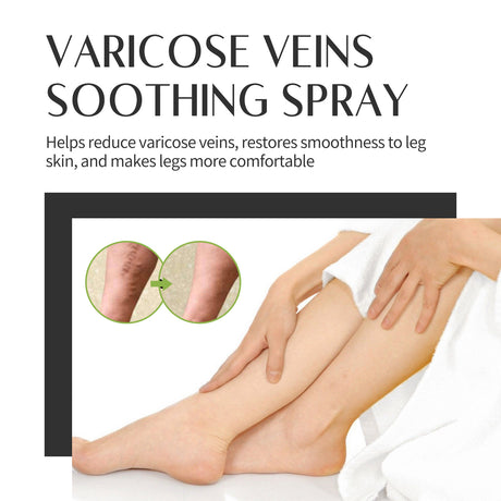 Varicose Veins Soothing Spray, Relief Of Sore Leg Muscles Massage Repair Earthworm Leg Vein Treatment Spray - V.I.P Digital Presence