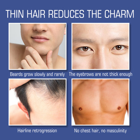 Facial Hair Growth Solution, Care For Men's Facial Hair Growth Solution To Nourish Thick Beard Growth - V.I.P Digital Presence