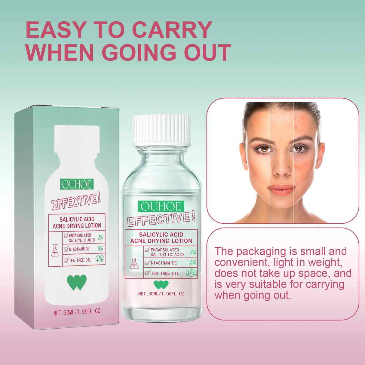 Salicylic Acid Acne Drying Lotion, Gentle Repair Acne-Skin Skin Moisturizing Lotion - V.I.P Digital Presence