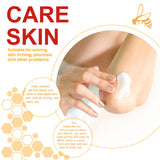 Bee-Poison Cowhide Moss Cream, Which Relieves Redness And Itchiness Of Skin - V.I.P Digital Presence