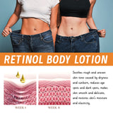 Retinol Body Bar, Massage Moisturizes Shapes Body And Tightens Body Bar - V.I.P Digital Presence