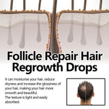 Follicle Repair Hair Regrowth Drops, Hair Protection Strong And Solid Hair Thickening Scalp Nourishing Massage Lotion - V.I.P Digital Presence