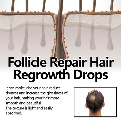 Follicle Repair Hair Regrowth Drops, Hair Protection Strong And Solid Hair Thickening Scalp Nourishing Massage Lotion - V.I.P Digital Presence