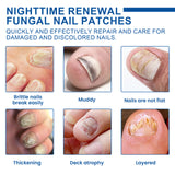 Nighttime Renewal Fungal Nail Patches, Repair And Thickening Gray Nail Insert Soft Nail Care Patch - V.I.P Digital Presence