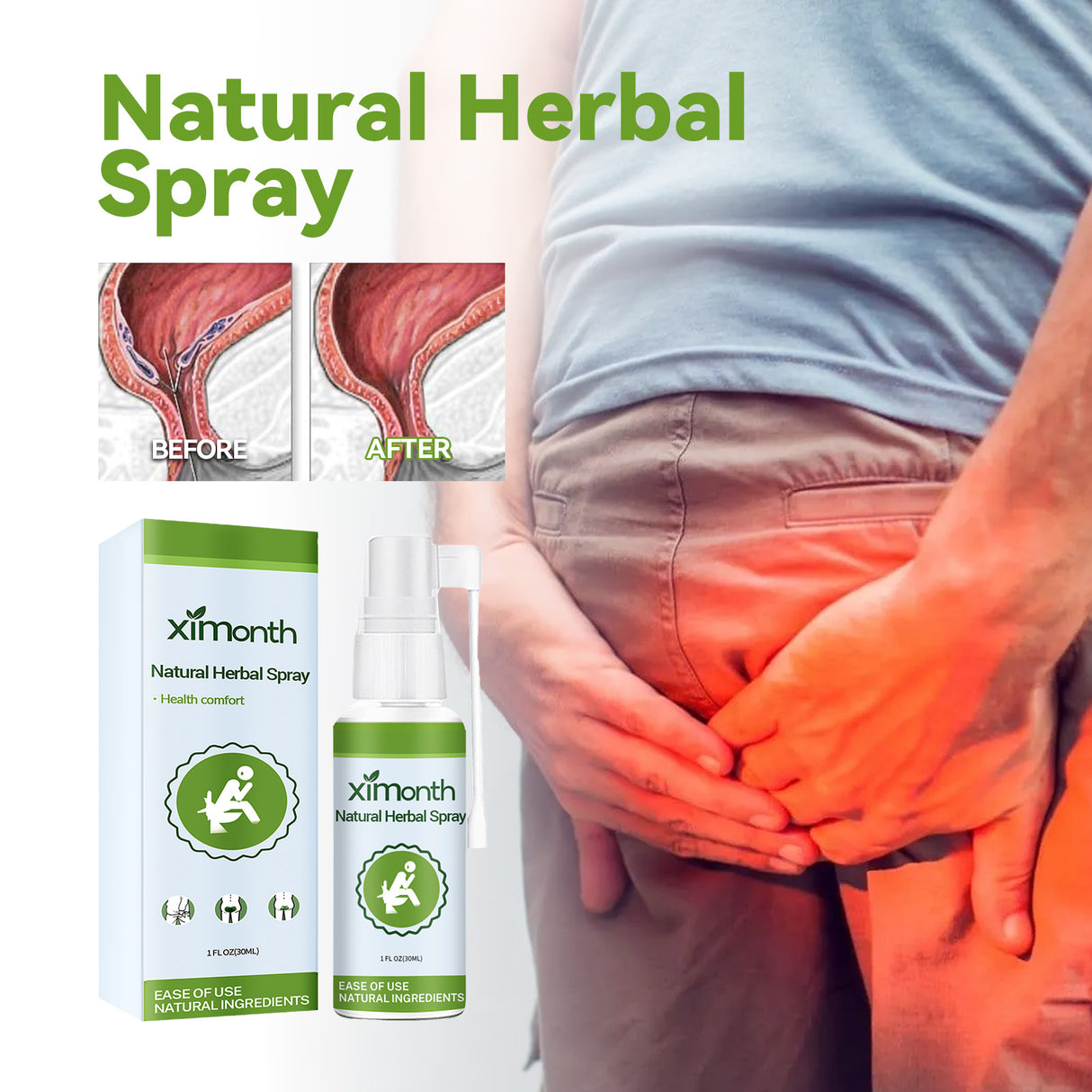 Natural Herbal Hemorrhoid Spray, Soothing Perianal Itchiness And Soothing Anal Care Spray - V.I.P Digital Presence