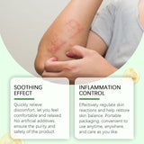 Herbal Skin Soothing Cream That Soothes And Nourishes Uncomfortable Skin With Body Skin Treatment Cream