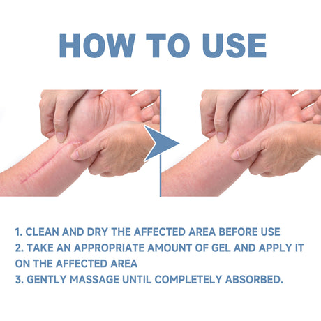 Oceaura Scar Whitening Repair Gel Moisturizes And Smooths Skin Repair Surgery Scar Pregnancy Care Gel - V.I.P Digital Presence