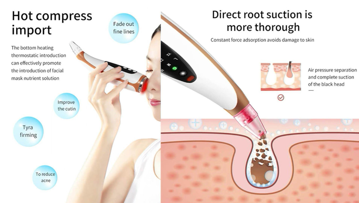 New Electric Suction Blackheads Pore Cleaning Surface Instrument Hot Compress Guide Out Acne Blackheads Beauty Instrument - V.I.P Digital Presence