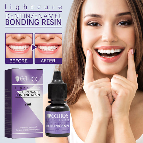 Tooth Gem Decorative Glue, DIY Fashionable Jewelry Bonding Teeth Gems Light Cured Adhesive Glue - V.I.P Digital Presence