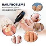 Nail Care Spray, To Reduce Brittle Nails By Layering Nail Strengthening Moisturizing Nutrient Solution - V.I.P Digital Presence