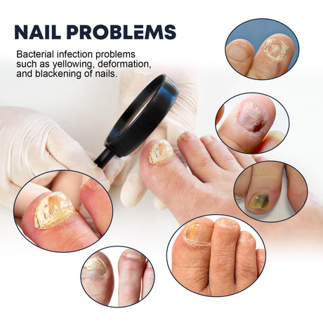 Nail Care Spray, To Reduce Brittle Nails By Layering Nail Strengthening Moisturizing Nutrient Solution - V.I.P Digital Presence