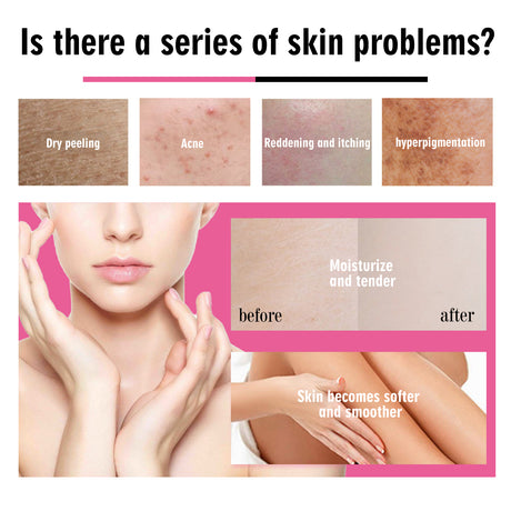 Body Care Oil Skin Dry Moisturizing Body Skin Firming Massage Essential Oil - V.I.P Digital Presence