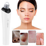 High-Definition Visual Blackhead Meter Three-Speed Intelligent Vacuum Adsorption Pore Cleaner Wifi Timing - V.I.P Digital Presence