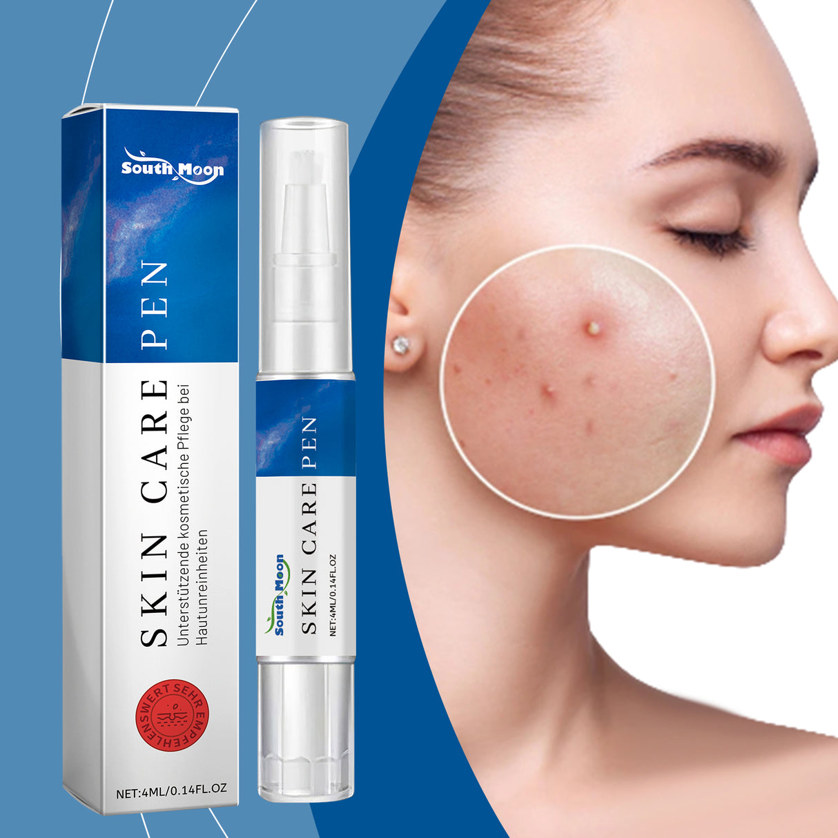 Acne Care Pen, Gently Clean Acne And Acne Closing Skin Daily Care Solution - V.I.P Digital Presence