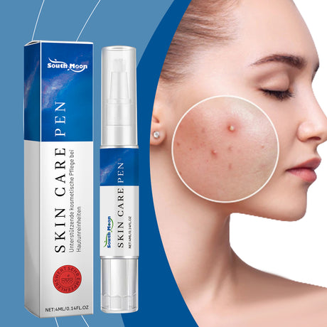 Acne Care Pen, Gently Clean Acne And Acne Closing Skin Daily Care Solution - V.I.P Digital Presence