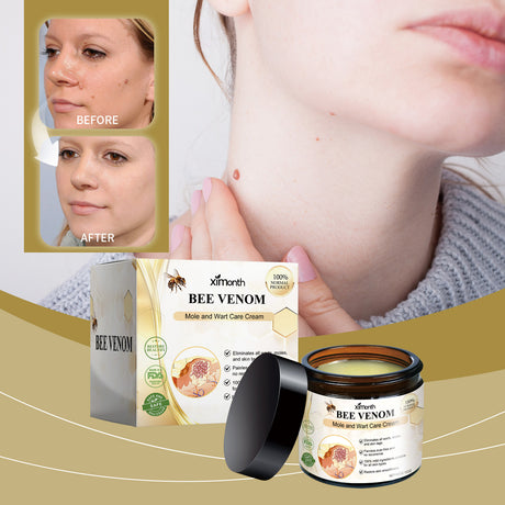 Mole And Wart Care Cream, Soft And Smooth Skin Moisturizing And Repairing Skin Care Cream - V.I.P Digital Presence