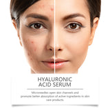 Hyaluronic Acid Face Serum, Radiant Facial Skin Improves Skin Pores And Hydrates