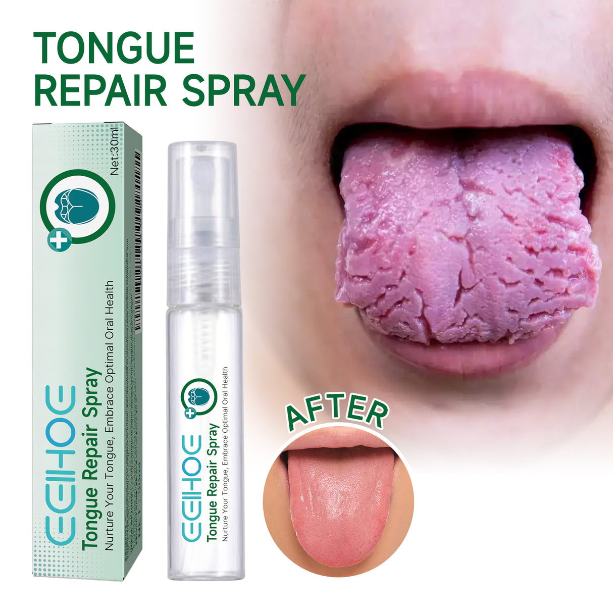 Tongue Repair Spray Repair Tongue Whitening To Relieve Dry, Cracked And Swollen Tongue Oral Care Spray - V.I.P Digital Presence