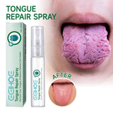 Tongue Repair Spray Repair Tongue Whitening To Relieve Dry, Cracked And Swollen Tongue Oral Care Spray - V.I.P Digital Presence