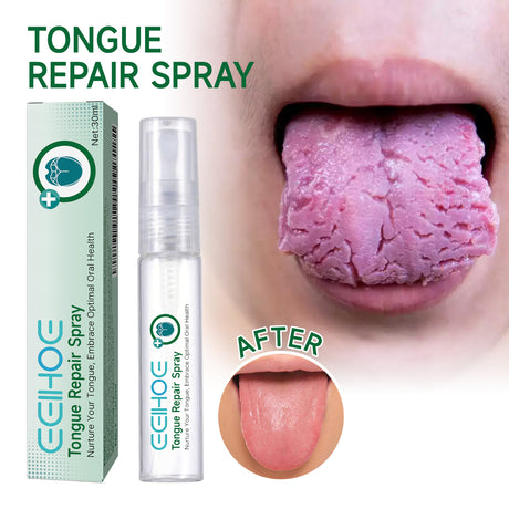 Tongue Repair Spray Repair Tongue Whitening To Relieve Dry, Cracked And Swollen Tongue Oral Care Spray - V.I.P Digital Presence