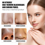 Remove Blackheads Peel Nose Mask, Deep Clean Remove Blackheads Acne And Tighten Pores Strawberry Nose Mask - V.I.P Digital Presence