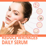 Rose Oil Vc Essence Improves Fine Lines Care For Rough And Dry Skin Brightening And Firming Skin Care Essential Oil - V.I.P Digital Presence