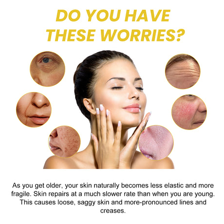 Snail 96 Collagen Essence Lighten Fine Lines, Tender Skin and Moisturize acne muscles - V.I.P Digital Presence