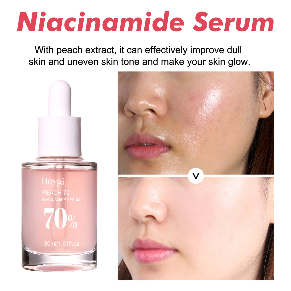 Nicotinamide Essence Tights And Moisturizes Pores, Lighens Acne Marks And Spots, Moisturizes And Brighens Skin - V.I.P Digital Presence