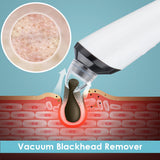 High-Definition Visual Blackhead Meter Three-Speed Intelligent Vacuum Adsorption Pore Cleaner Wifi Timing - V.I.P Digital Presence