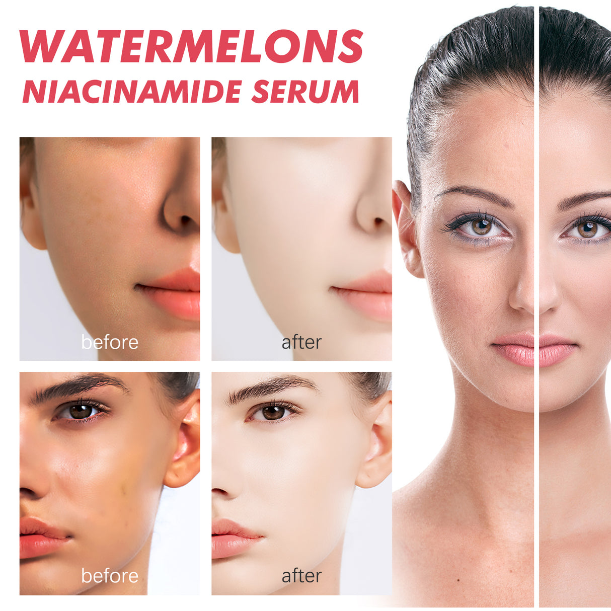 Watermelons Niacinamide Serum, Dilute Spots Firming Haun White Skin Hydrating Moisture Essence - V.I.P Digital Presence