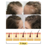 Ginger Dense Hair Soap, Moisturizes Hair Ends And Roots Cleansing Scalp Hair Care Shampoo Soap - V.I.P Digital Presence