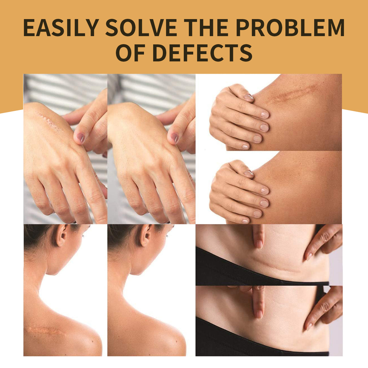 Invisible Concealer, Skin Concealer Tattoo Scar Cover Invisible Waterproof Skin Tone Cover