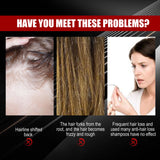 Black Rice Hair Spray Strengthen And Strengthen Hair Dense Hair Hydrating Repair Root Soft Hair Growth Spray - V.I.P Digital Presence