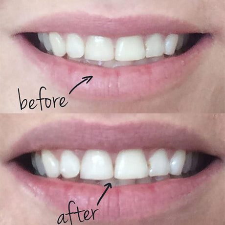 30g Teeth Whitening Scaling Powder Oral Hygiene Cleaning Packing Premium Activated Bamboo Charcoal Powder - V.I.P Digital Presence