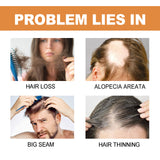 Mypa Ampoule, Strengthen And Repair Hair, Prevent Hair Loss, Strengthen Hair Root And Thicken Hair And Scalp Massage Solution - V.I.P Digital Presence