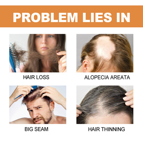 Mypa Ampoule, Strengthen And Repair Hair, Prevent Hair Loss, Strengthen Hair Root And Thicken Hair And Scalp Massage Solution - V.I.P Digital Presence