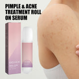 Acne Acne Ball, And Cleansing Skin Chest Back Acne Closing Skin Care - V.I.P Digital Presence