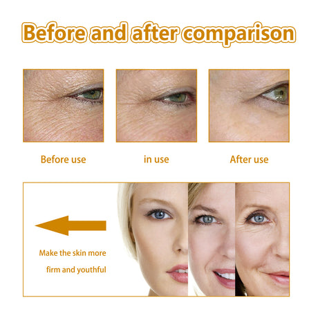 Collagen Anti-Wrinkle Serum, Hydrating And Smoothing Fine Lines, Firming Face And Elastic Moisturizing Skin Essence - V.I.P Digital Presence