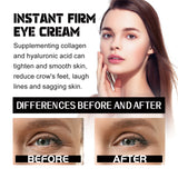 Eye Firming and Lifting Cream Reduces fine lines and Wrinkles, firming and Moisturizing Skin, hydrating and anti-wrinkle eye cream - V.I.P Digital Presence
