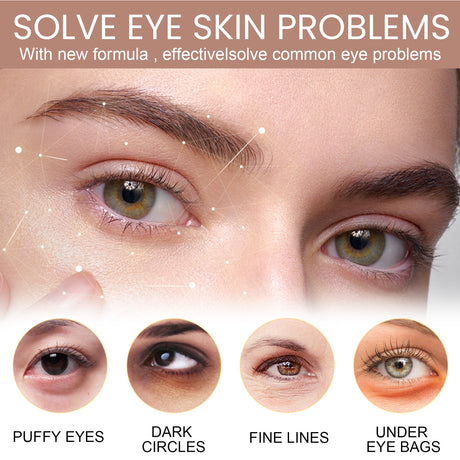 Ouhoe Eye Moisturizer Stick Moisturizes Skin Around Eyes - V.I.P Digital Presence