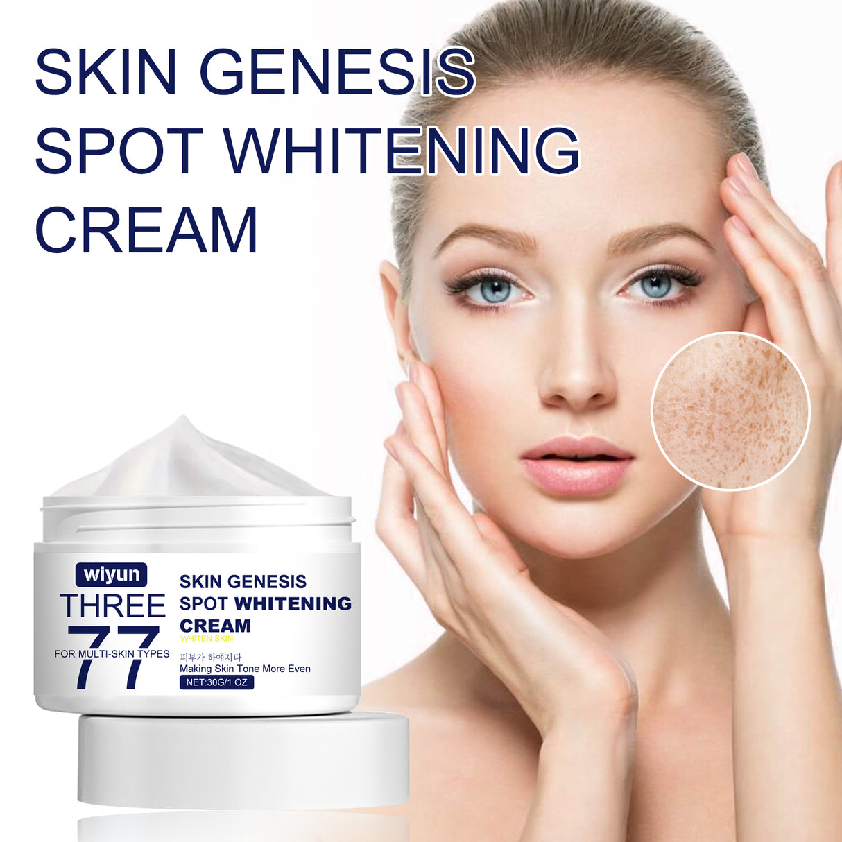 Skin Genesis Spot Whitening Cream, Filling Water To Moisten Soft Delicate Chun White Brighten The Melanin Of Skin Cream - V.I.P Digital Presence