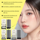 Blackhead Pore Patch Series Gently Clean The Pores Of The Nose Blackhead Acne Is Not Tight