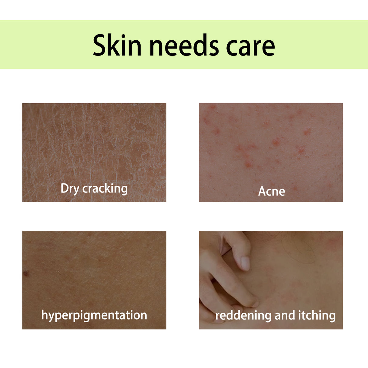 Handcrafted Body Oil, Moist Curing Firming Skin Relief Fatigue Plant Aroma Aromatic Therapy Oil - V.I.P Digital Presence