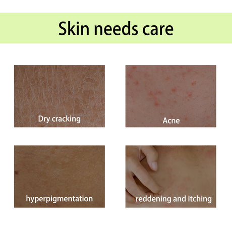 Handcrafted Body Oil, Moist Curing Firming Skin Relief Fatigue Plant Aroma Aromatic Therapy Oil - V.I.P Digital Presence