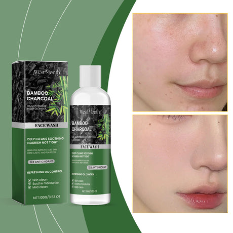 Charcoal Facial Cleanser Cleans Facial Skin From Oil And Dirt, Keeps Moisturizing, Refreshing And Oil Controlling - V.I.P Digital Presence