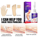 Remove Chicken Eye Lotion Extra Clear Remove Corns Skin Care Chicken Calluses Foot Pad Gram Warts - V.I.P Digital Presence