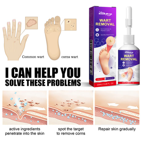 Remove Chicken Eye Lotion Extra Clear Remove Corns Skin Care Chicken Calluses Foot Pad Gram Warts - V.I.P Digital Presence