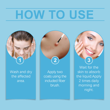 Keyu Liquid Hand And Foot Skin Especially Moles Cleansing Repair Smooth Skin Skin Label Care Liquid - V.I.P Digital Presence