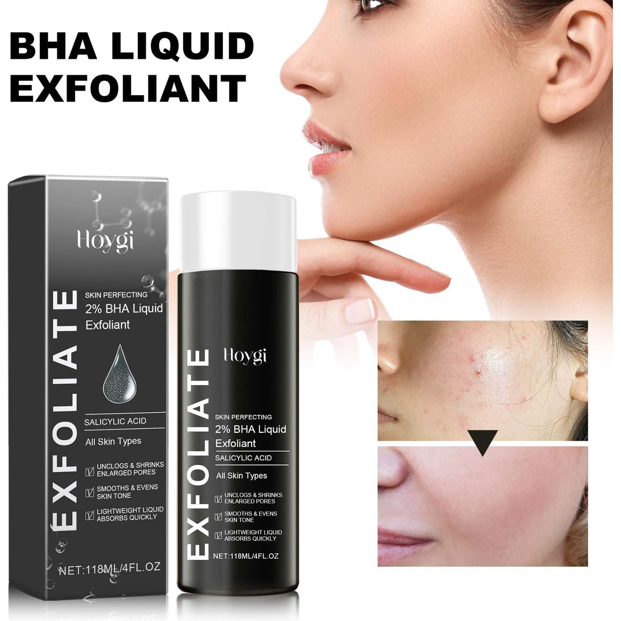 BHA Liquid Exfoliant, Lightening Acne Seal Pore-Tightening And Moisturizing Skin Essence - V.I.P Digital Presence