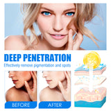 Blemish Cream, Whitening Skin Reduce Melanin Melasma Stains And Hydrating Cream - V.I.P Digital Presence